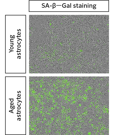 Two fluorescence microscope images of cells. These show that cytokine-induced responsiveness differs depending on the ageing state of astrocytes.