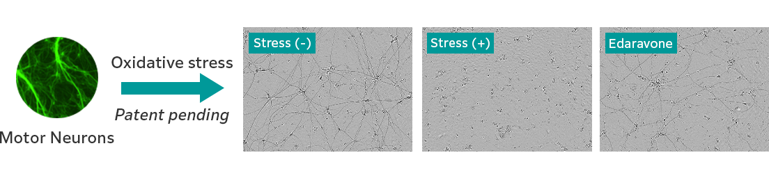 Fluorescent microscope images and three photographs of motor neurons. These images show changes in the length of motor neuron axons in the absence of oxidative stress, in the presence of oxidative stress, and in the presence of edaravone.