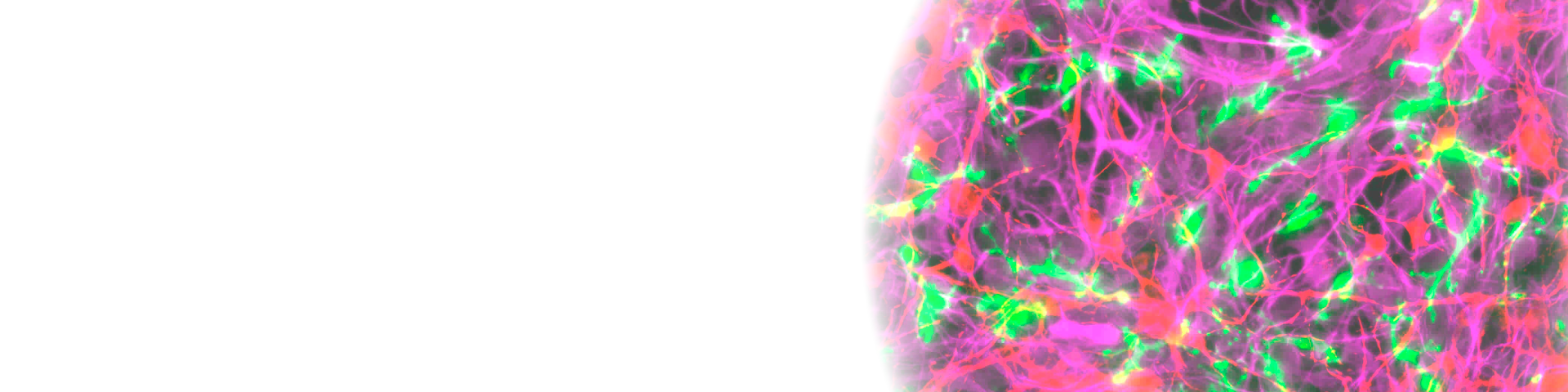 Fluorescent microscope image of co-cultured neurons in the right half. Neurons, astrocytes, and microglia are coloured red, pink, and green, respectively, showing intercellular interactions similar to those in the brain.
