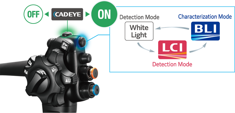 Scope switches of the endoscope handle.