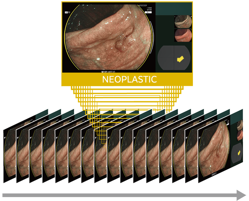 CAD EYE characterization processing continuous image frames in high speed.