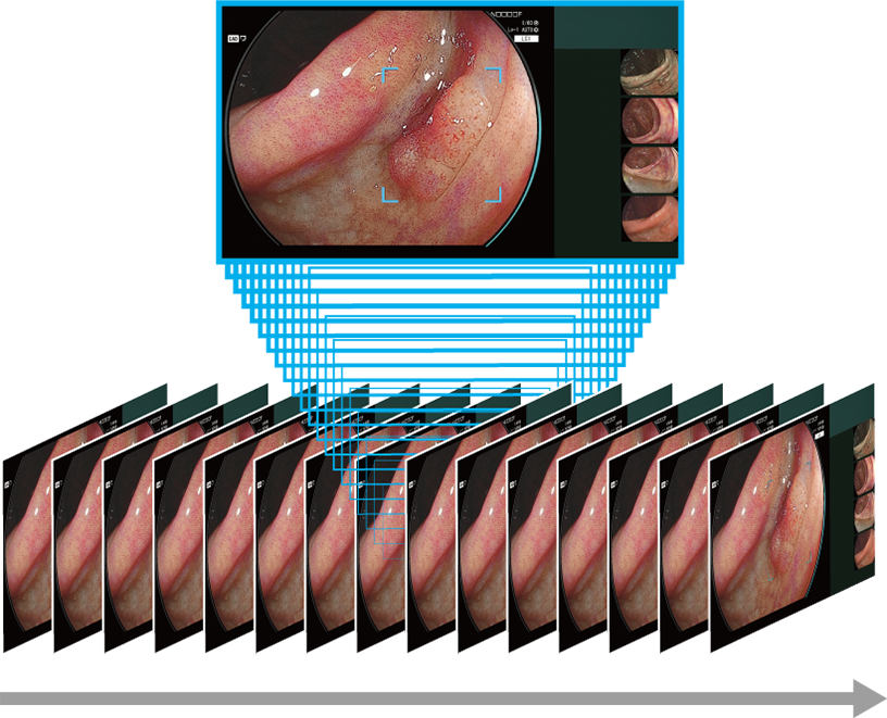 CAD EYE detection processing continuous image frames in high speed.