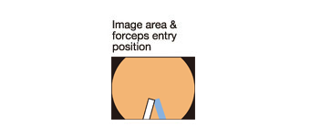 Image area & forceps entry position