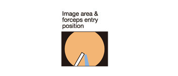 Image area & forceps entry position