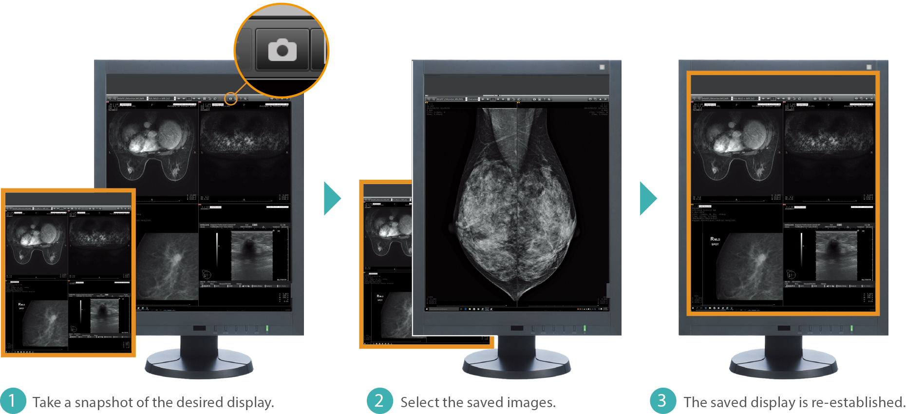 [image] Close-up view of Snapshot function that display conditions, order, and scale factor of each image