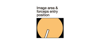 [image] Image area & forceps entry position