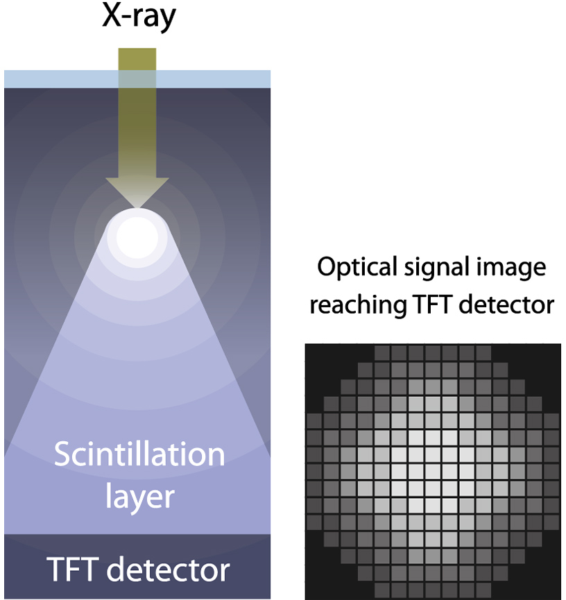 [image] Conventional X-ray method​​