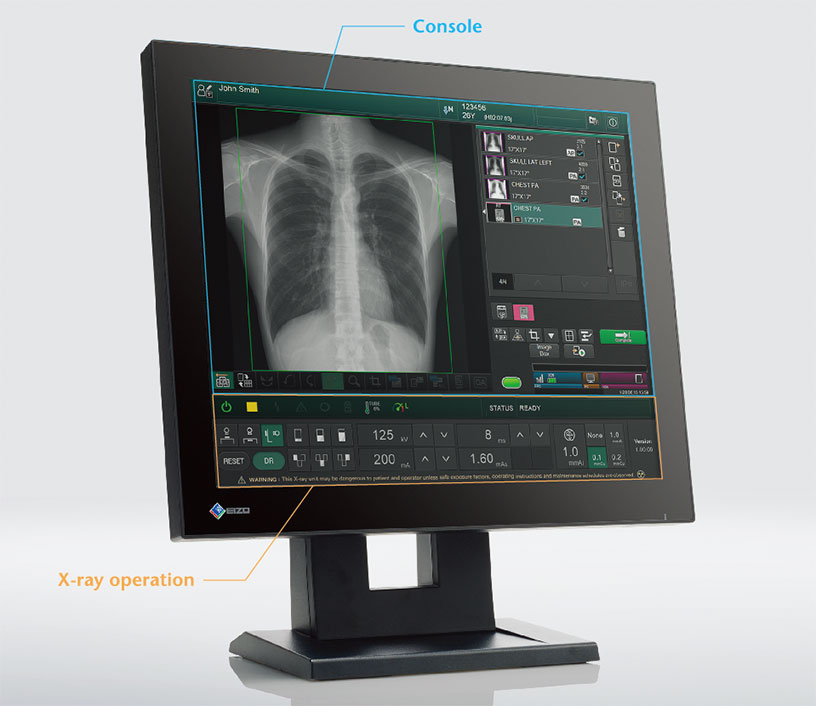 [photo] A computer monitor with the Console section bordered in blue and X-ray Operation section bordered in orange