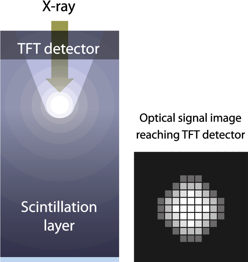[image] ISS system reading technology for X-rays​​
