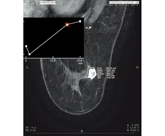 [image] Time intensity curve X-rays