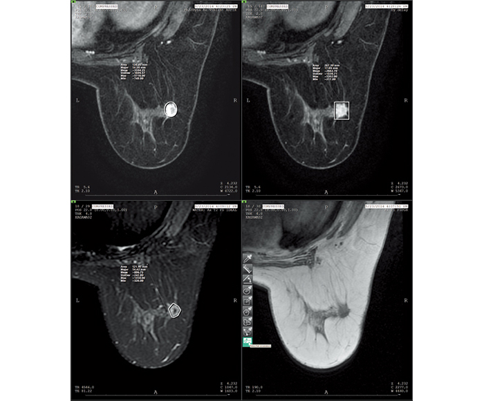 [image] ROI (Region of interest) X-ray