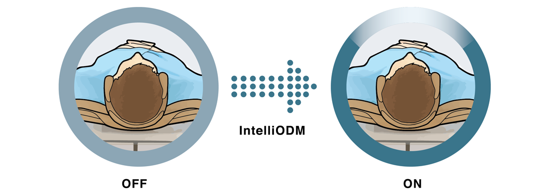 IntelliODM
