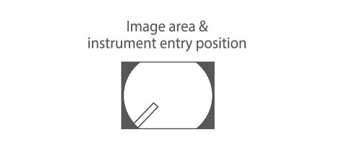 Image area & forceps entry position