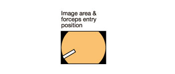 [image] Image area & forceps entry position