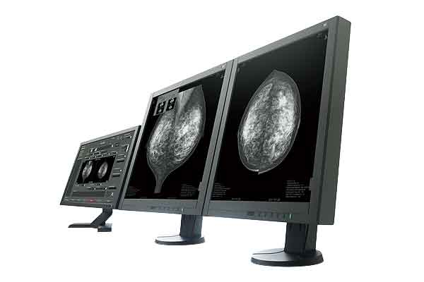 [photo] AMULET BellusⅡ 