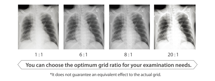 Grid ratio image