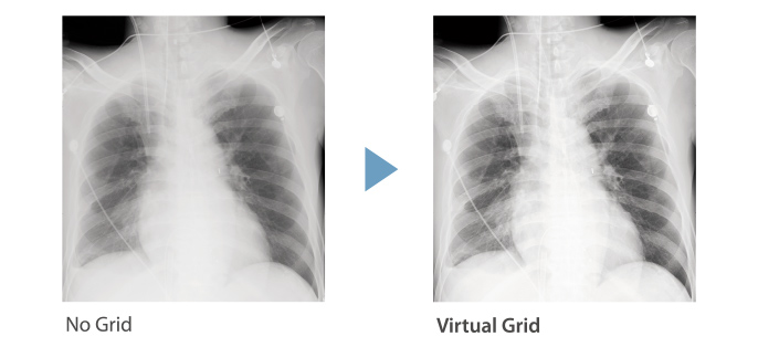 image de comparaison de grille