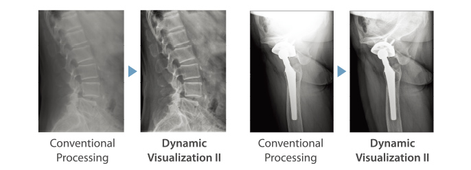 traitement conventionnel vs image de visualisation dynamique