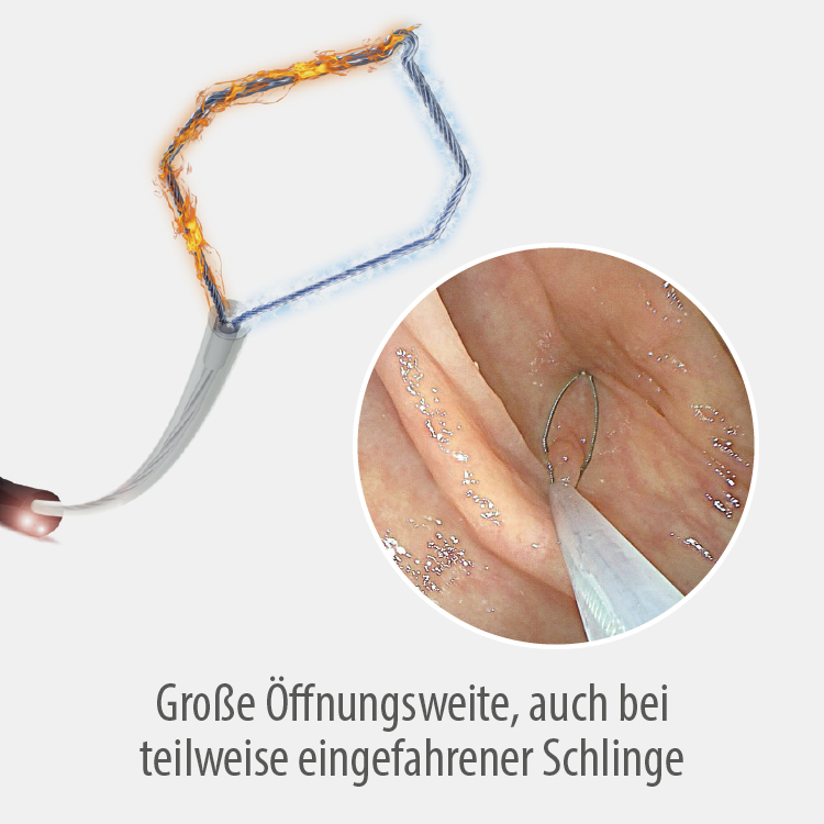 CrossSnare für die Abtragung