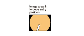 [image] image area & forceps entry position