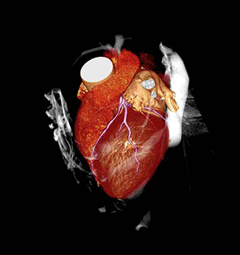 [image] 3D red human heart