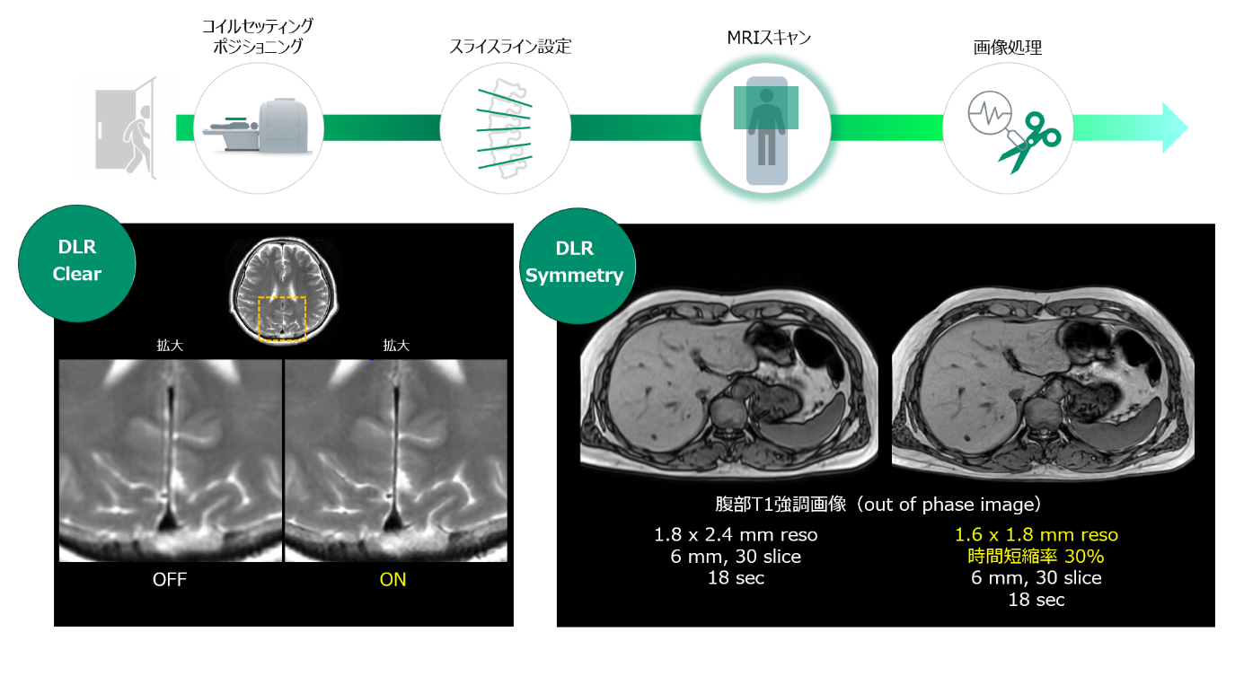 新ソフトウェア搭載1.5テスラ超電導MRIシステム新発売 | 富士フイルム
