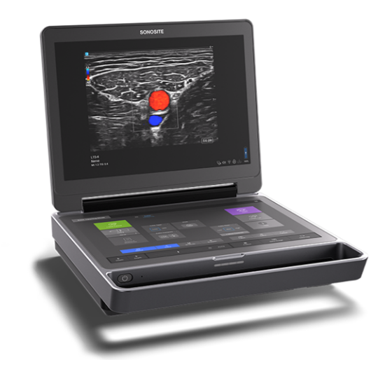 超高周波超音波画像診断装置「Sonosite LX」、超音波画像診断装置