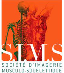SIMS
