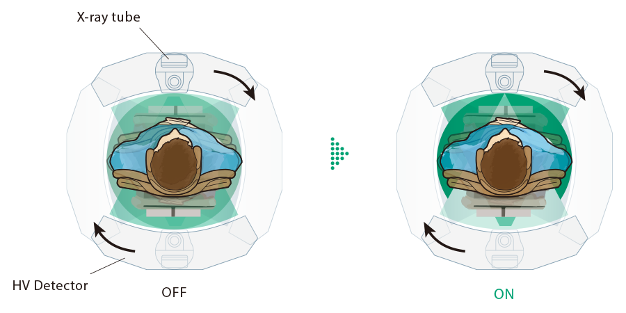 Here are comparative images illustrating the difference in X-ray exposure between cases without and with the IntelliODM function.