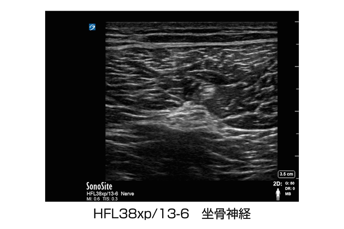 HFL38xp/13-6 坐骨神経