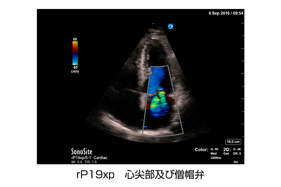 rP19xp 心尖部及び僧帽弁