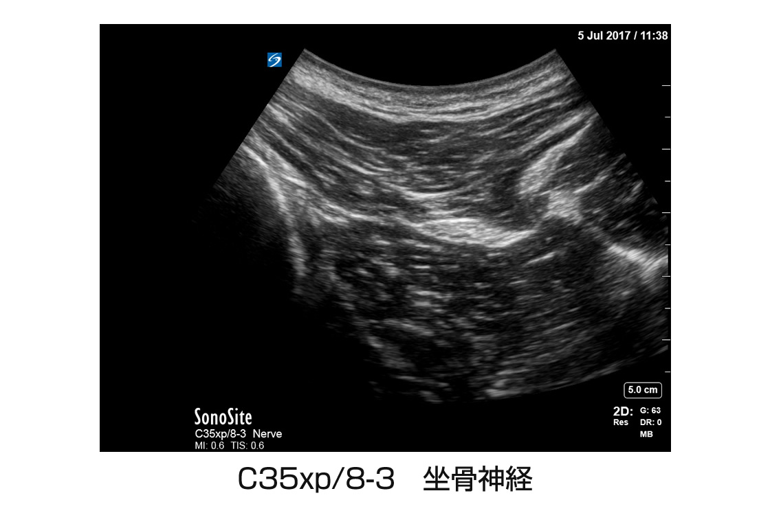 C35xp/8-3 坐骨神経