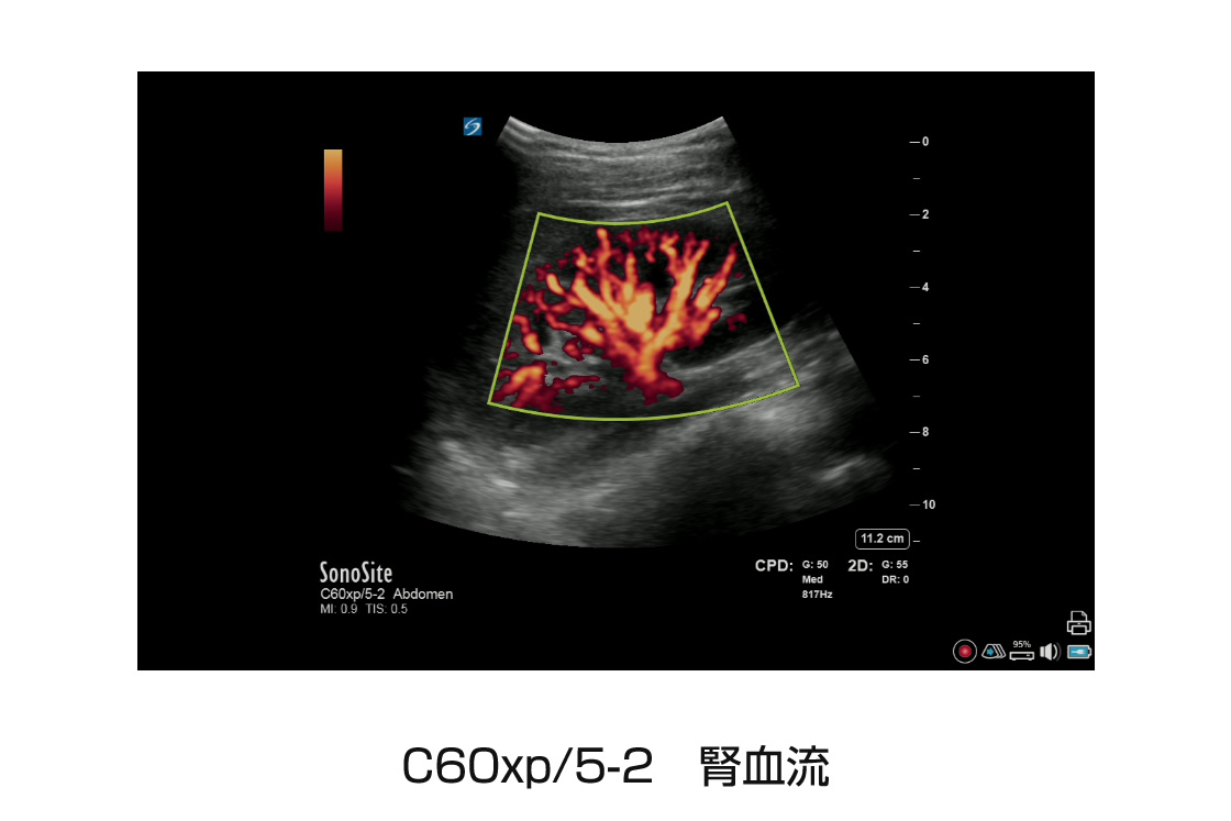 C60xp/5-2 腎血流