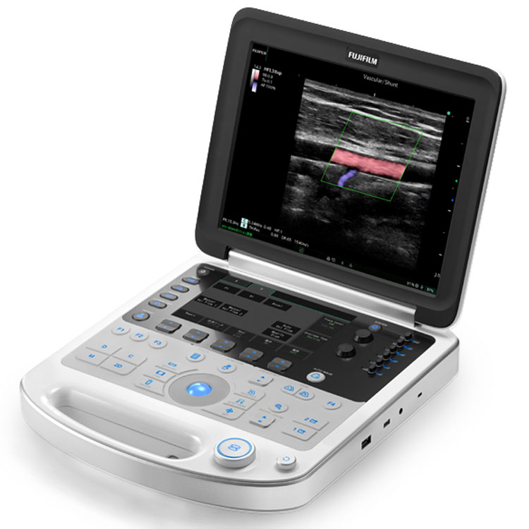 超音波画像診断装置 FC1-X VA | 富士フイルム [日本]