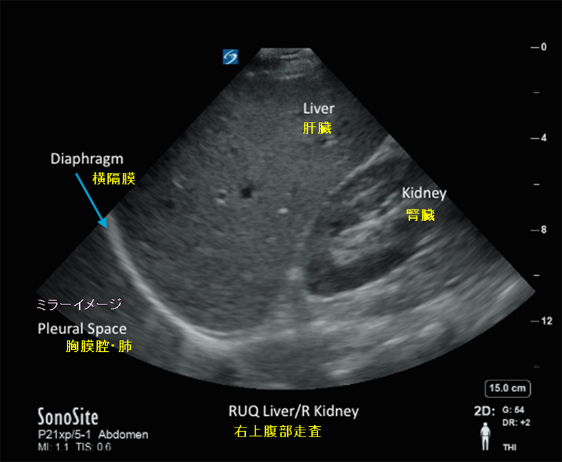 何を期待するか