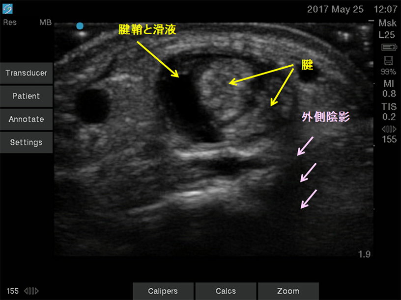 テスト結果をどのように解釈すればよいですか?