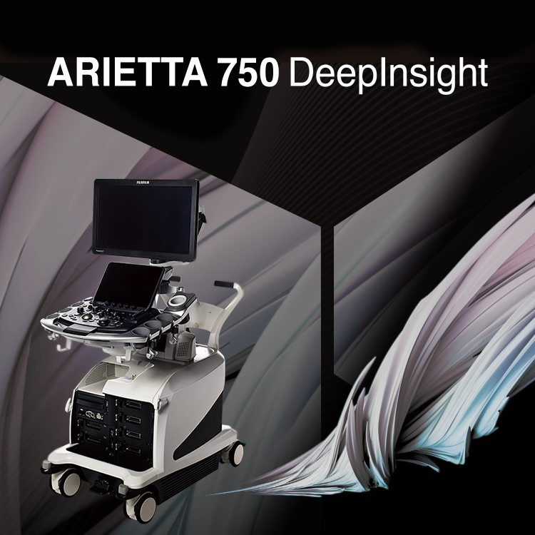 ARIETTA 750 DeepInsight | 富士フイルム [日本]