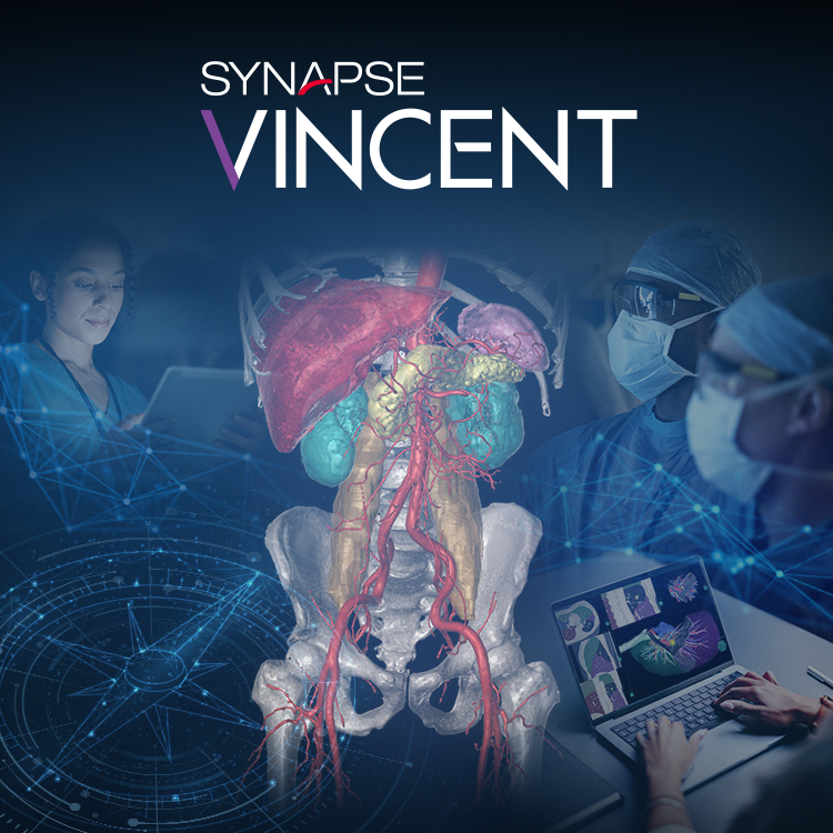 3D画像解析システム SYNAPSE VINCENT | 富士フイルム [日本]