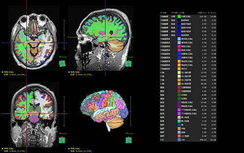 3D画像解析システム SYNAPSE VINCENT : アプリケーション | 富士