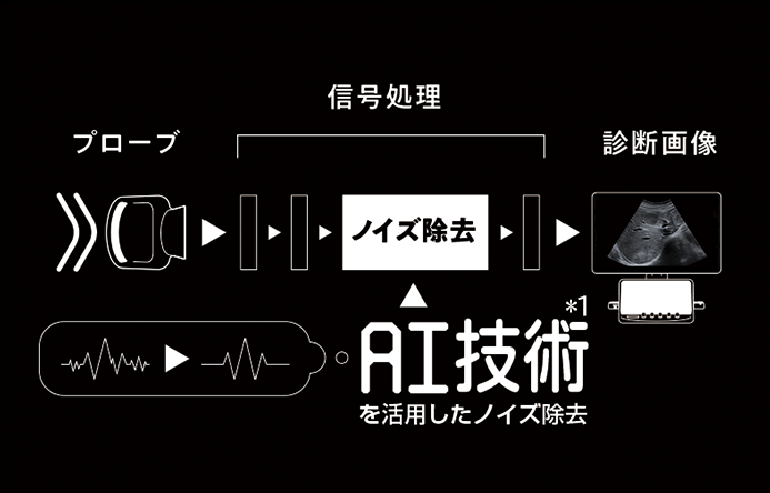 DeepInsight Technology 画質処理開発においてAI技術*1を使用したDeepInsight技術は、膨大な情報から必要な情報のみを抽出し、ノイズに埋もれていた微細な組織や複雑な組織構造をより明瞭に表現することが可能となりました。より自然な表現で組織を描出します。