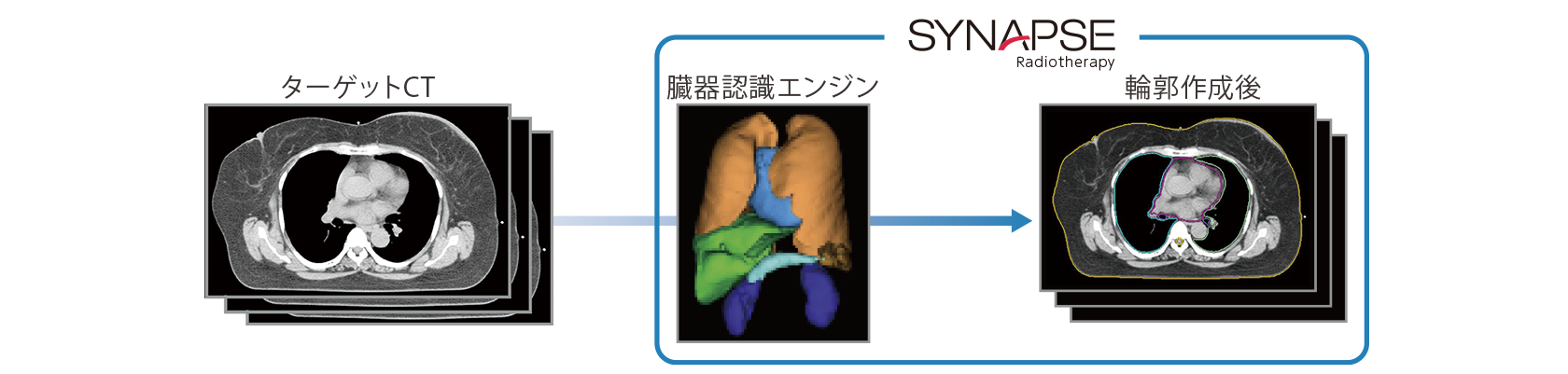 輪郭作成のフロー