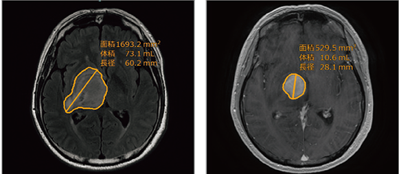 頭部関心領域セグメンテーションのイメージ図