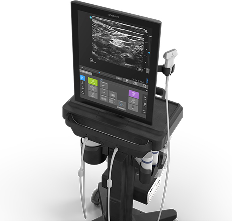 Sonosite STは全画面タッチスクリーンで直感操作が可能