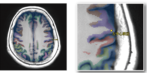 脳区域ラベルのイメージ図