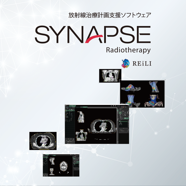放射線治療計画支援ソフトウェア SYNAPSE Radiotherapy | 富士