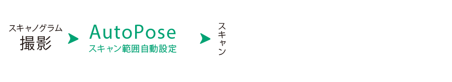AutoPose機能で短縮したCT撮影の流れの図​