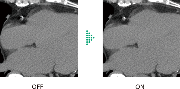 Cardio StillShot機能 ONとOFFの臨床画像