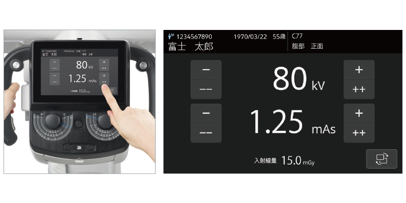 FUJIFILM DR CALNEO Go iQ : セカンドモニタ | 富士フイルム [日本]