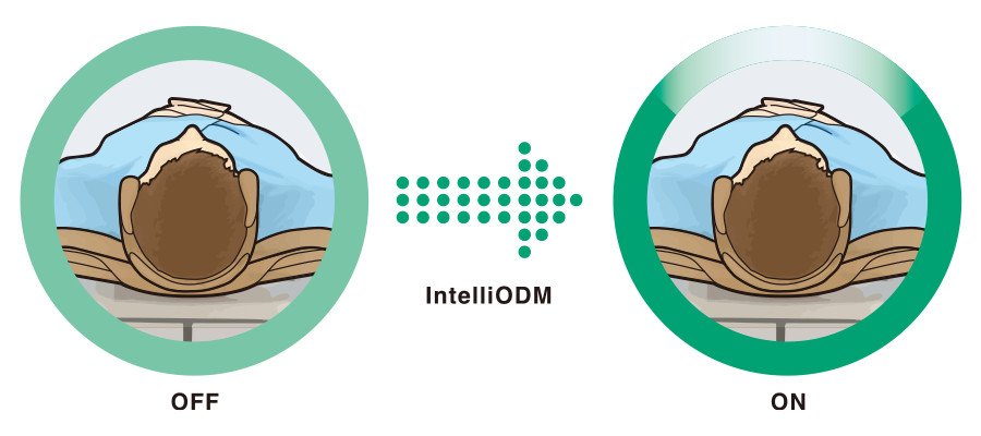 InteliODM機能がONとOFFでの1回転中の照射線量の比較図 
