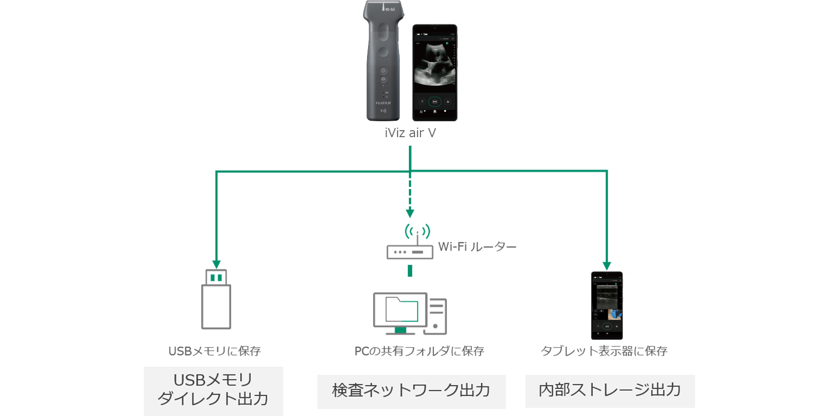 iViz air V コンベックス | 富士フイルム [日本]